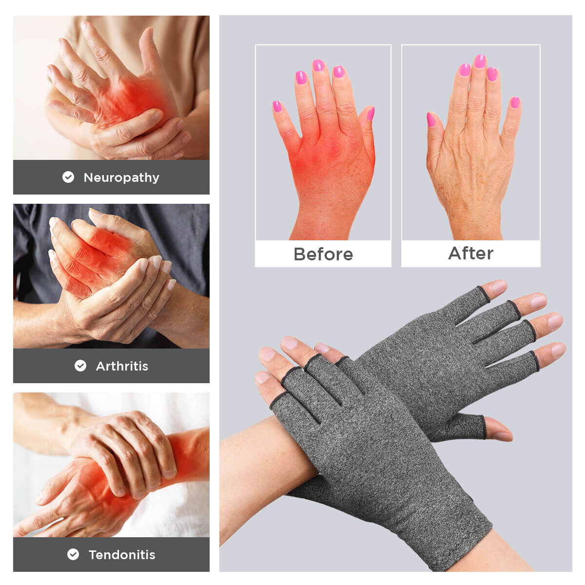 [50% OFF] Dr.Arthritis™ Compression Gloves