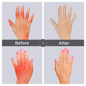 1 Pair - Dr.Arthritis™ Compression Gloves